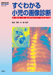 すぐわかる小児の画像診断